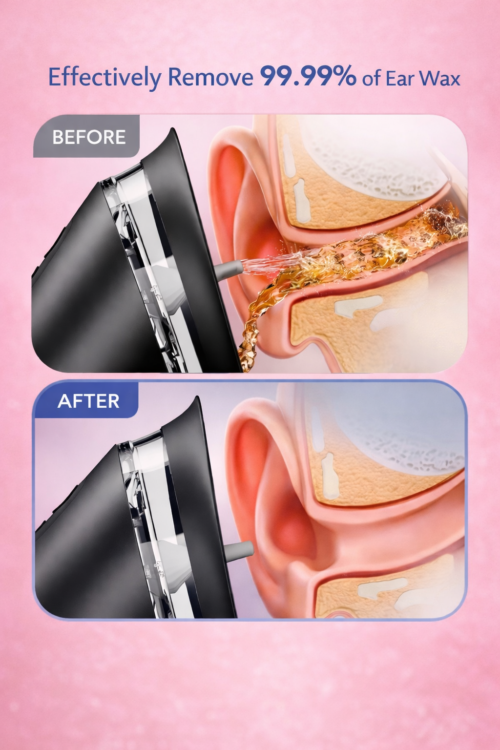 3-Mode Electric Ear Cleaning System
