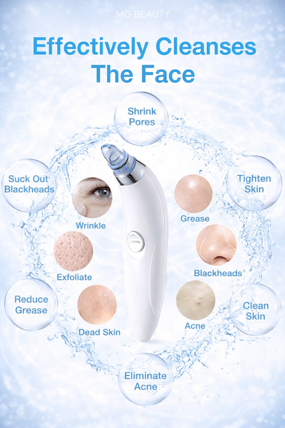 Portable Facial Pore Cleaner